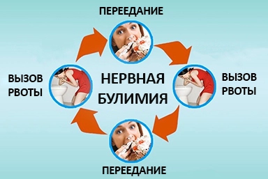 Лечение булимии в Арамиле